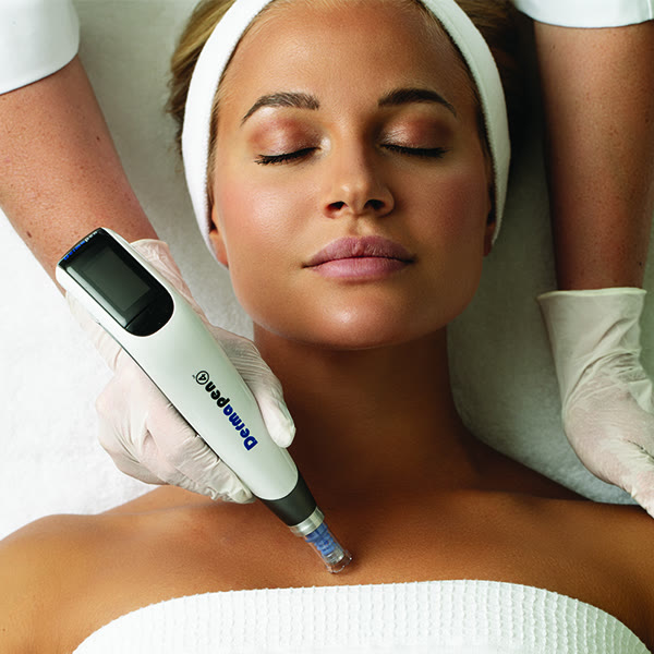 Microneedling mit dem Dermapen 4
